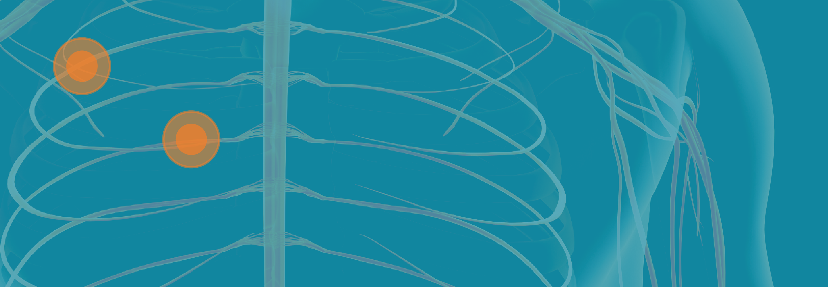 Human ribs and pain management