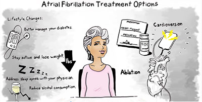 Atrial Fibrillation treatment options graphic