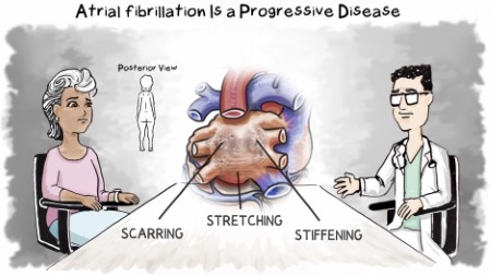 Atrial Fibrillation disease graphic