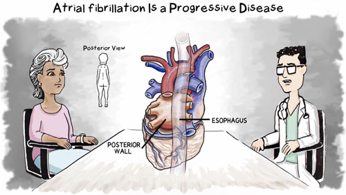 Atrial Fibrillation disease graphic