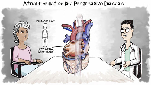 Atrial Fibrillation disease graphic